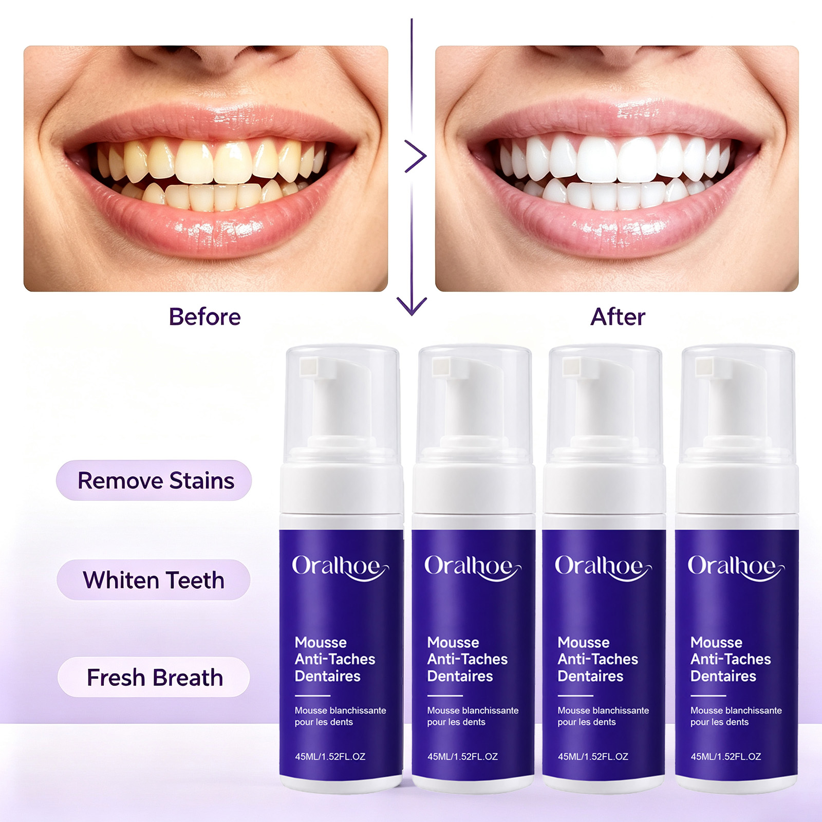 Teeth Whitening Routine - معجون أسنان رغوي بنفسجي لتبييض الأسنان