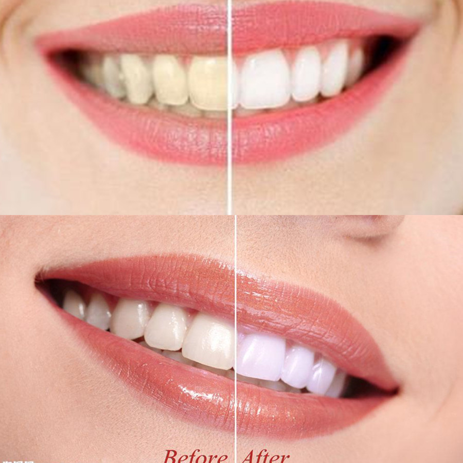 الخيزران الفحم الأسنان الأسنان - مراجعة Teeth Paint Whitening وسعره