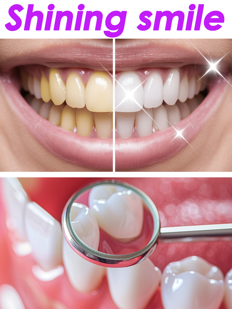 GlorySmile تبييض الأسنان معجون - مراجعة Teeth Whitening Xylitol وسعره