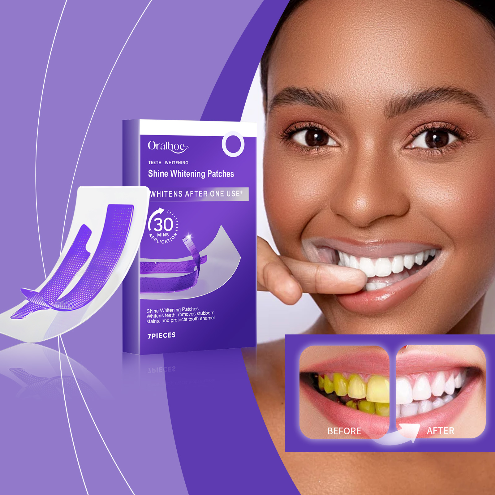 شرائط تبييض الأسنان باللون الأ - مراجعة Teeth Whitening Strips Crest وسعره