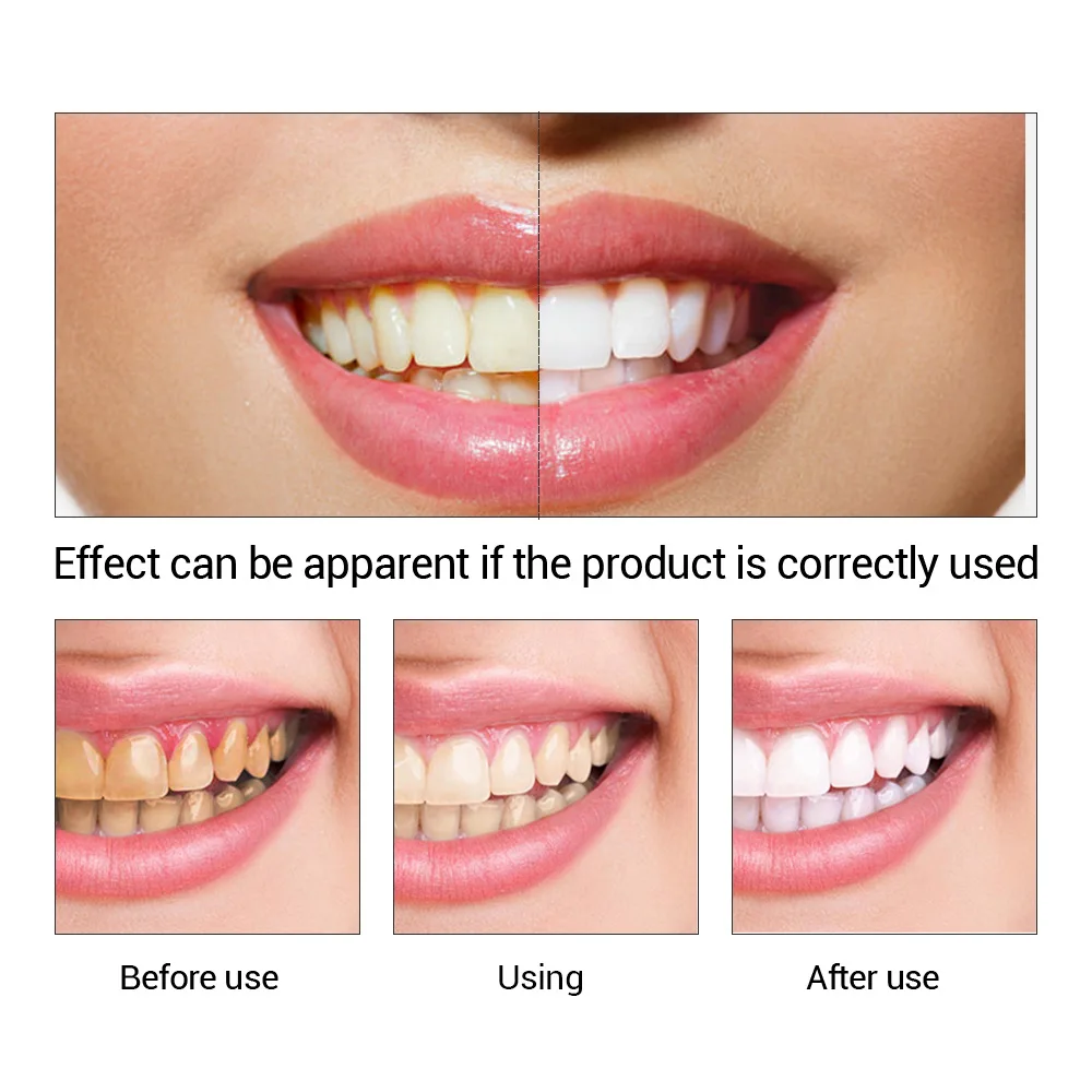 Fteenly تبييض الأسنان جوهر مسح - مراجعة Teeth Paint Whitening وسعره