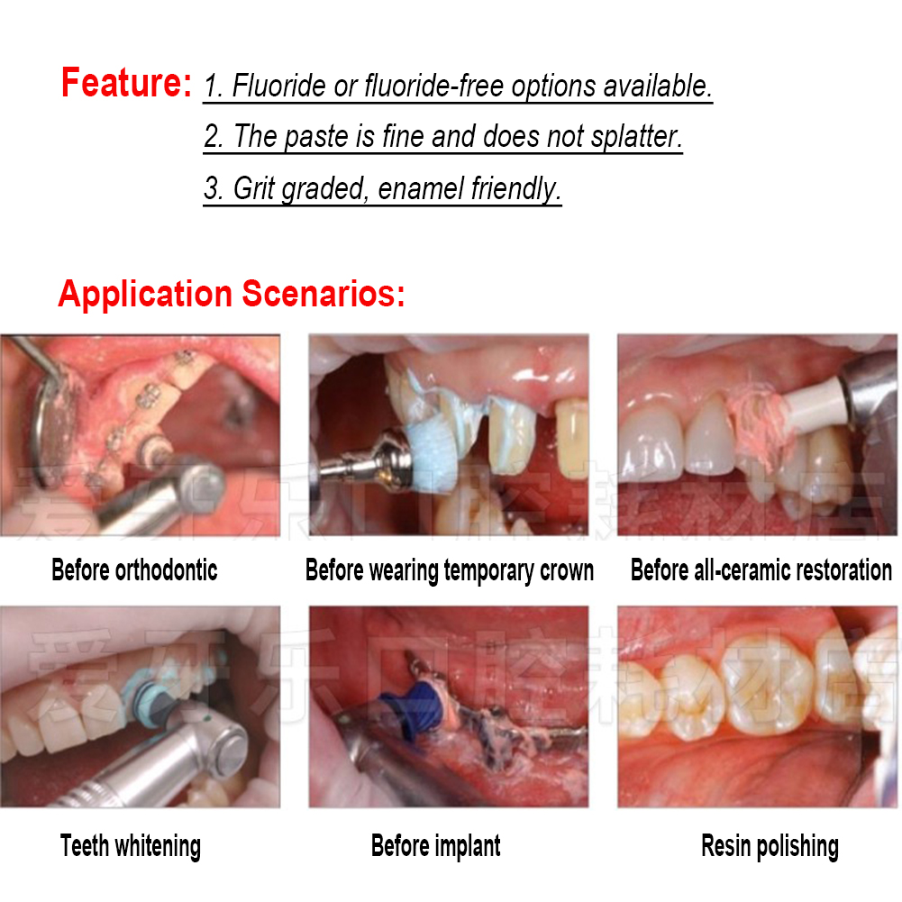 معجون تلميع الأسنان من إيفوكلا - مراجعة Teeth Whitening Xylitol وسعره