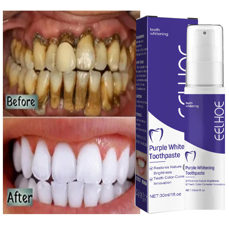 1 قطعة تنظيف الأسنان تبييض معج - مراجعة Teeth Whitening Korea وسعره