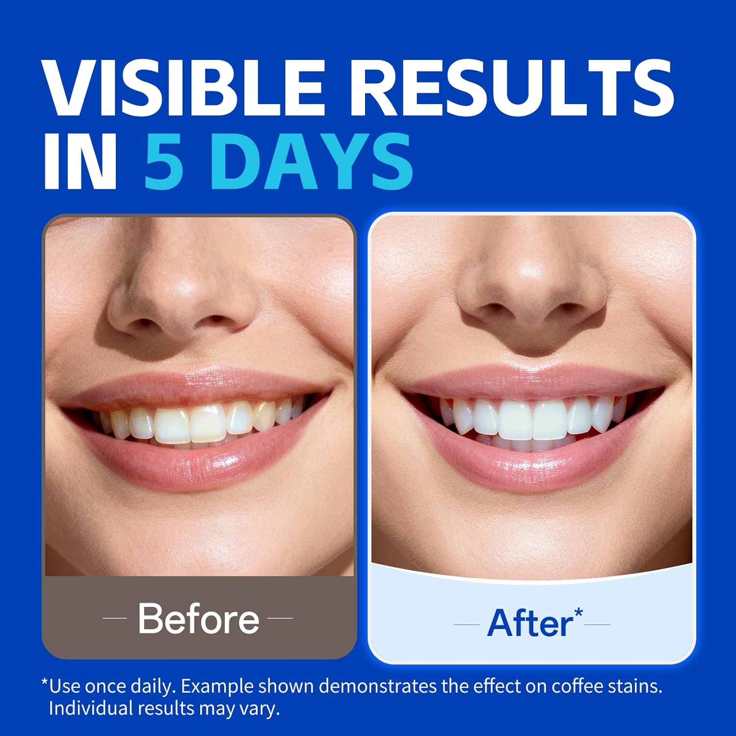 1/7 أزواج من شرائط تبييض الأسن - مراجعة Teeth Whitening Strips Crest وسعره