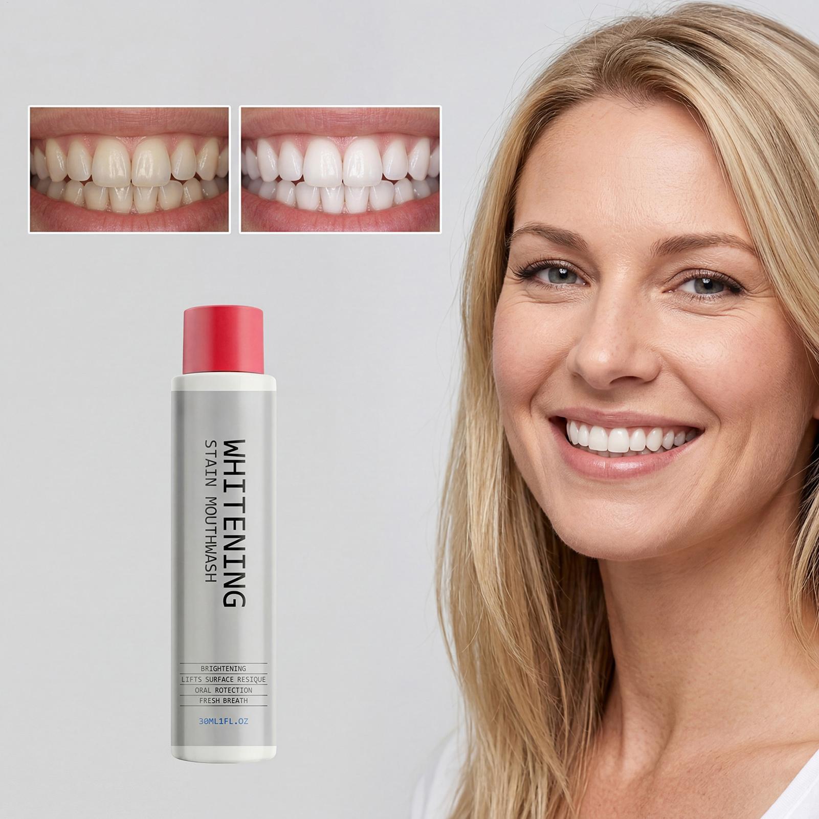غسول فم مبيض للبقع 30 مل، يزيل - مراجعة Whitening Mouthwash وسعره