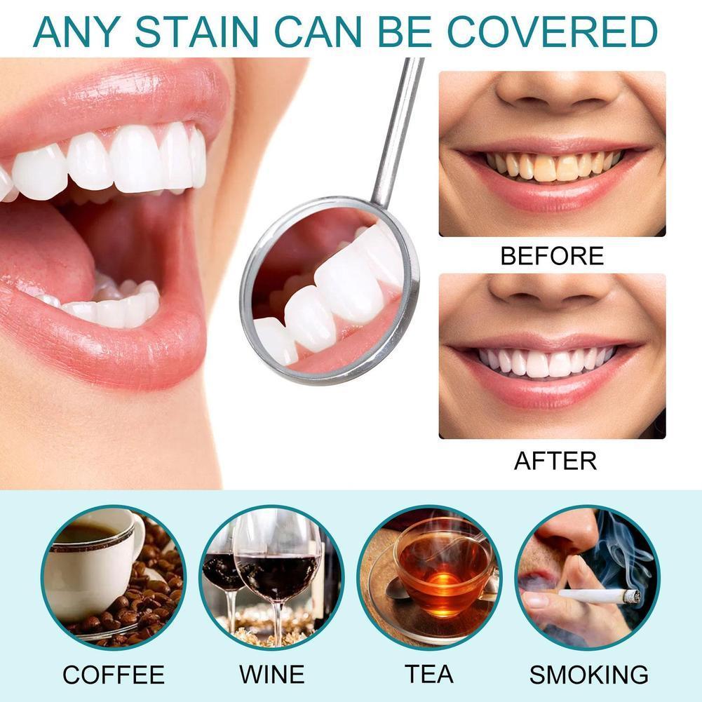 طلاء تبييض الأسنان مضاد للتصبغ - مراجعة Teeth Paint Whitening وسعره