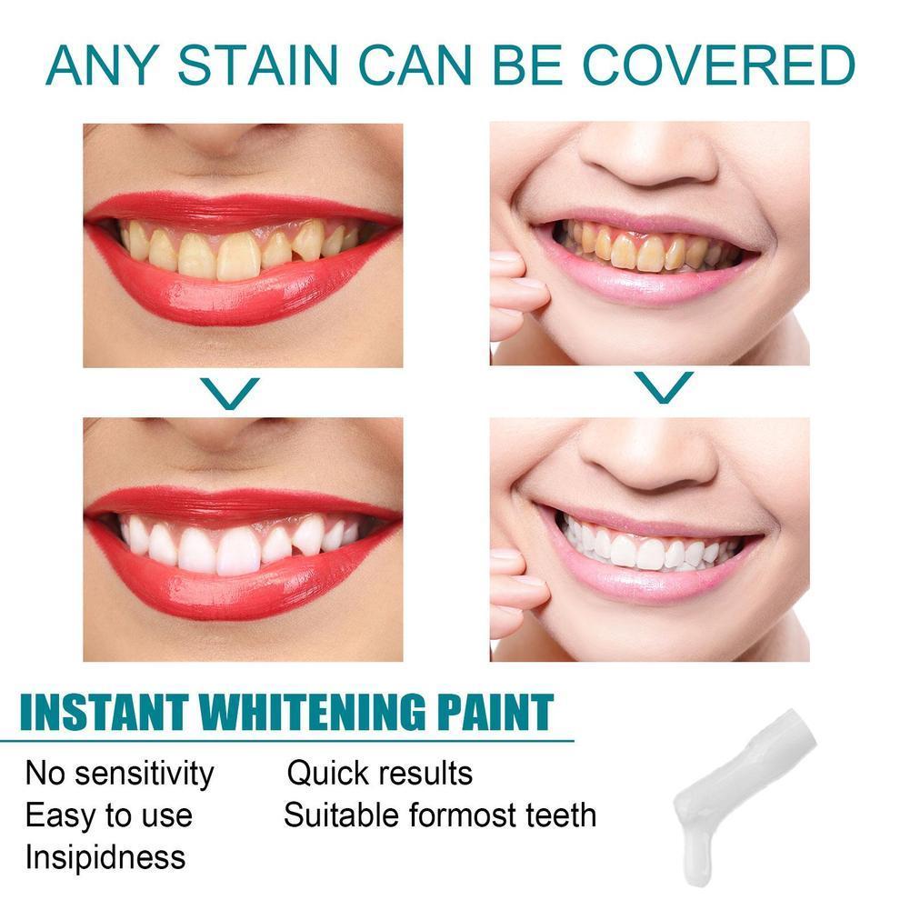 طلاء تبييض الأسنان مضاد للتصبغ - مراجعة Teeth Paint Whitening وسعره