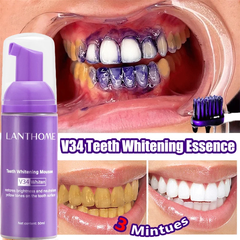 V34 معجون أسنان موس لتبييض الأ - مراجعة Teeth Whitening Xylitol وسعره