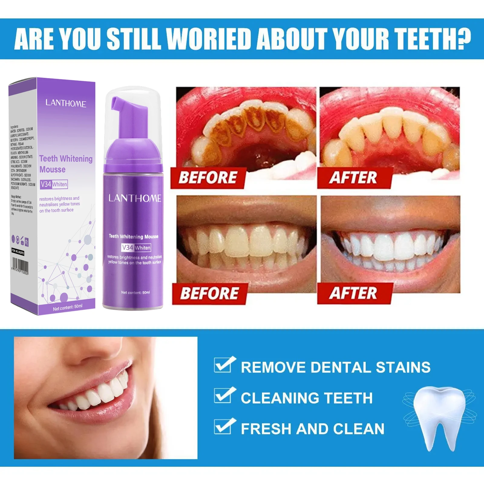 V34 معجون أسنان موس لتبييض الأ - مراجعة Teeth Whitening Xylitol وسعره