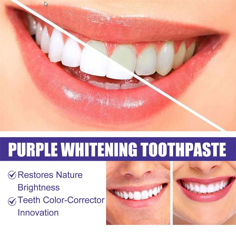 معجون أسنان لتبييض وتنظيف الأس - مراجعة Teeth Whitening Korea وسعره