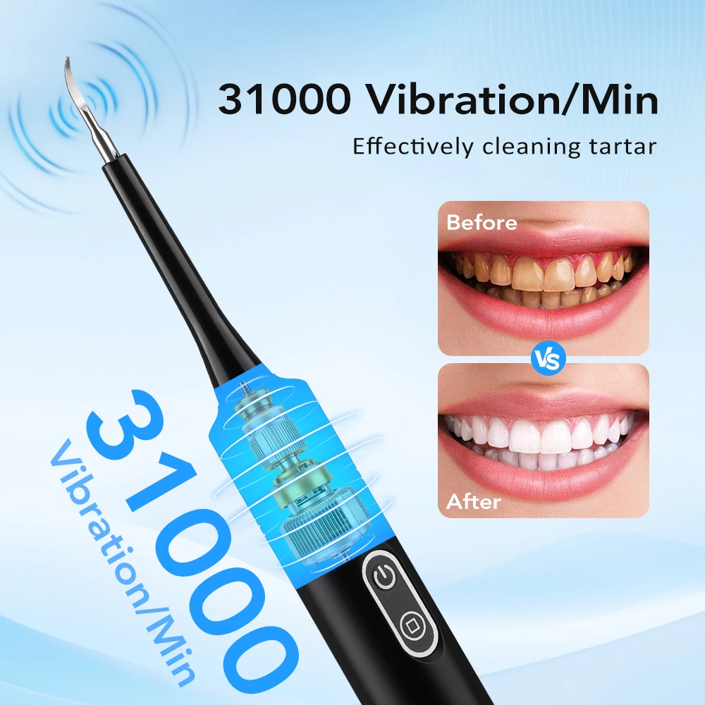 جهاز تنظيف الأسنان بالاهتزاز ا - مراجعة Electric Toothbrush Sonic وسعره